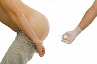 Mengatasi wasir pada ibu hamil, cara menyembuhkan ambeien atau wasir, cara herbal mengobati penyakit ambeien, obat ambeien atau wasir yang paten, obat ambeyen setelah operasi, pengobatan wasir atau ambeien yang alami, obat wasir hesmin, pengobatan herbal ambeien berdarah, jual obat untuk penyakit ambeien di simpang tiga redelong, cara mengobati ambeien atau wasir atau wasir secara alami, jual obat untuk penyakit wasir alami